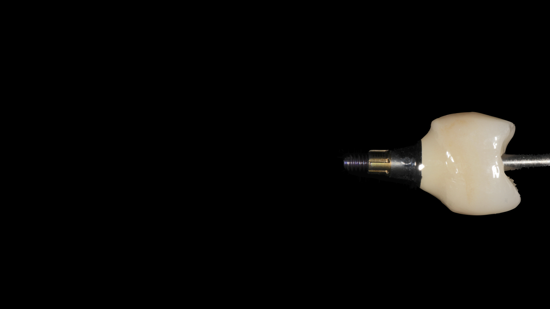 chirurgie, implants, sinus lift