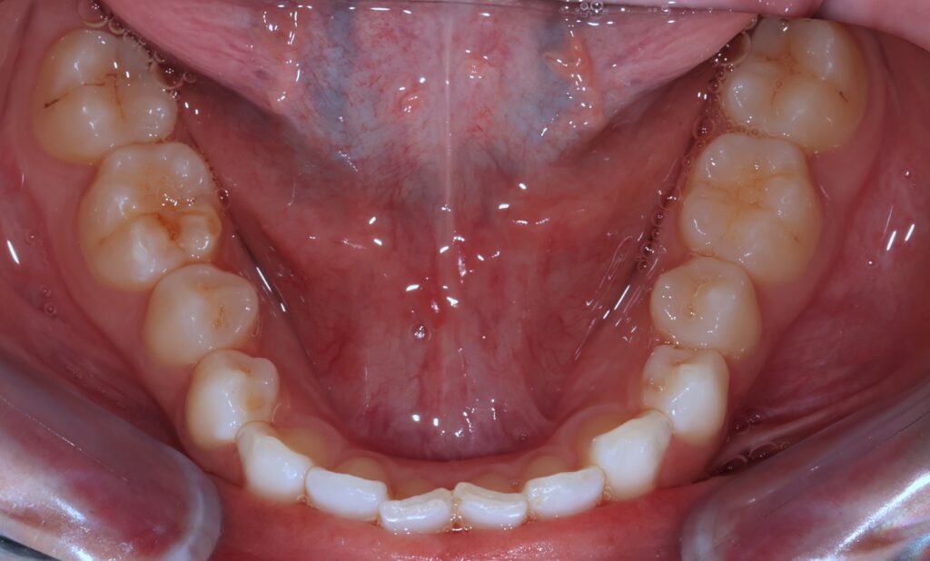orthodontie